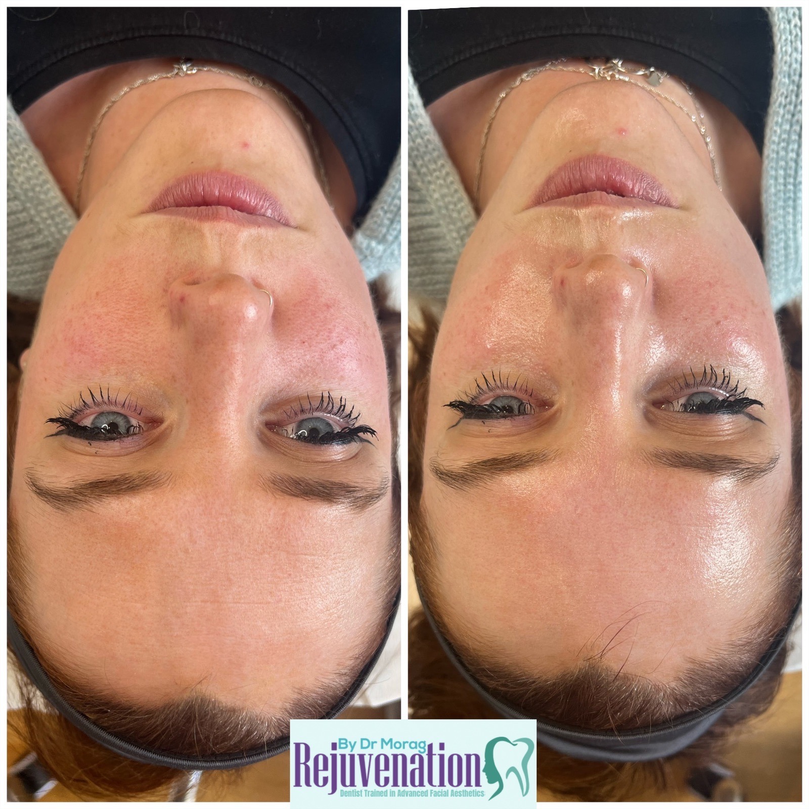 eZy Watermark_20-04-2022_09-57-31pm