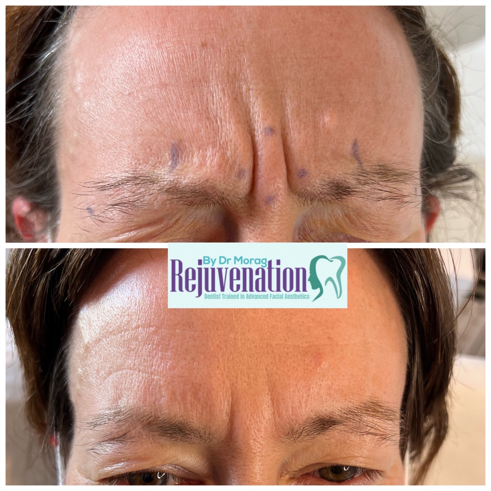 eZy Watermark_28-04-2022_11-29-29am