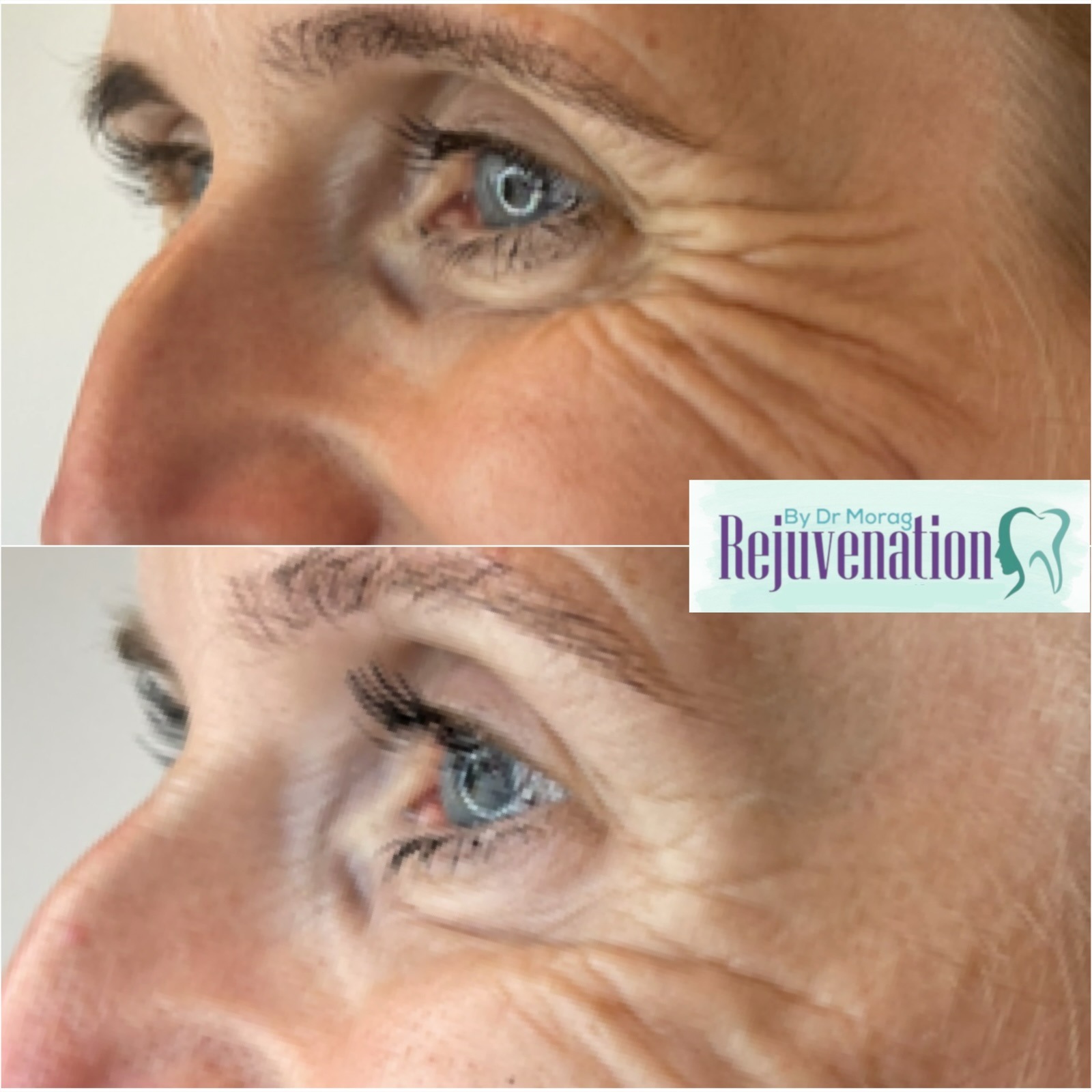 eZy Watermark_03-02-2026_12-18-42-2710pm