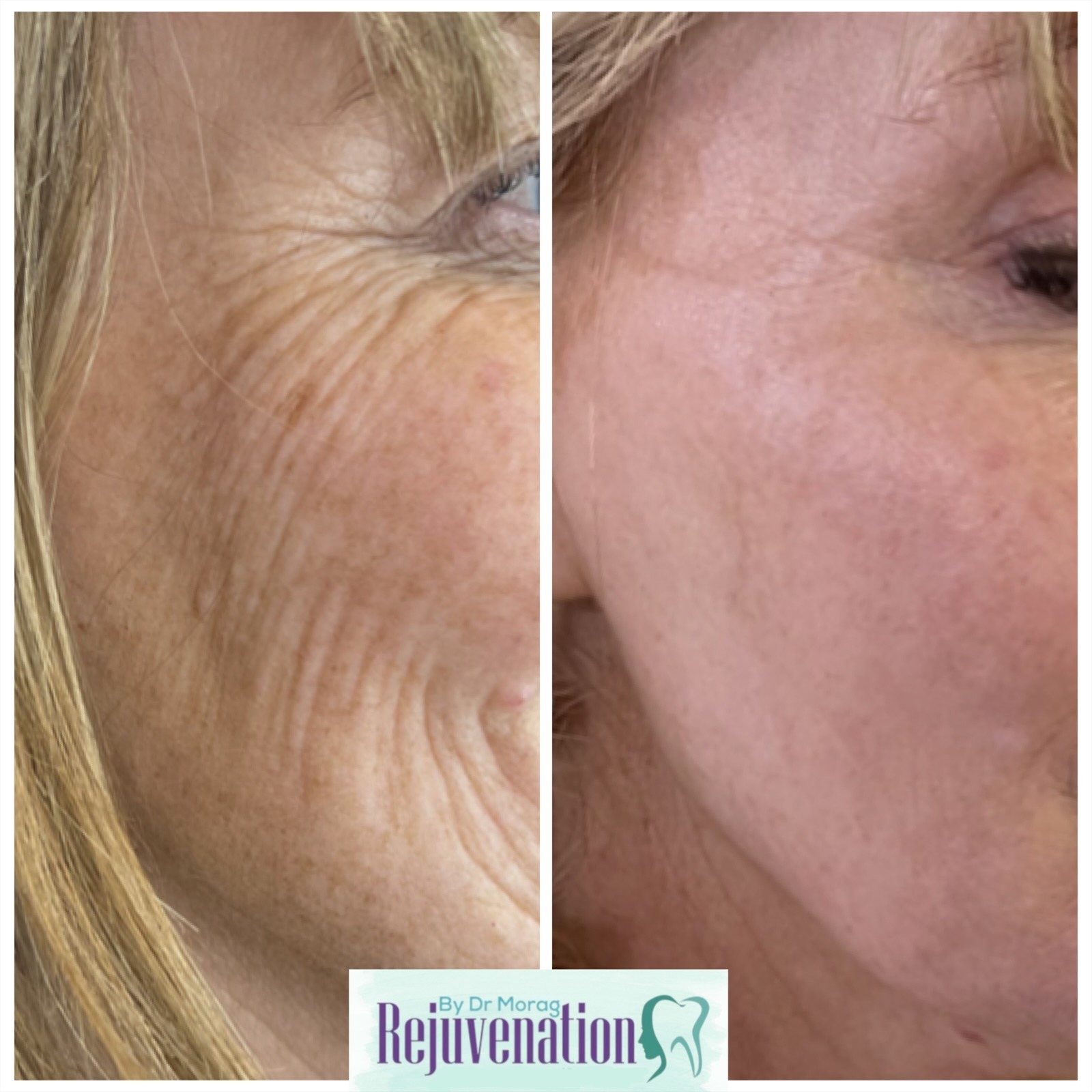 eZy Watermark_09-02-2026_07-04-30-1260pm